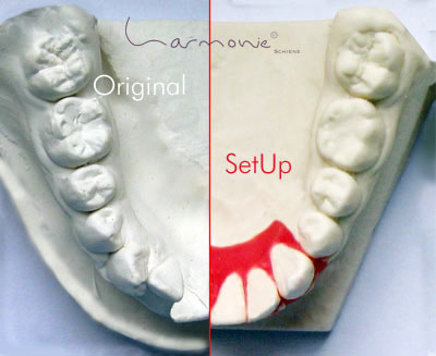 harmonieschiene_setup 